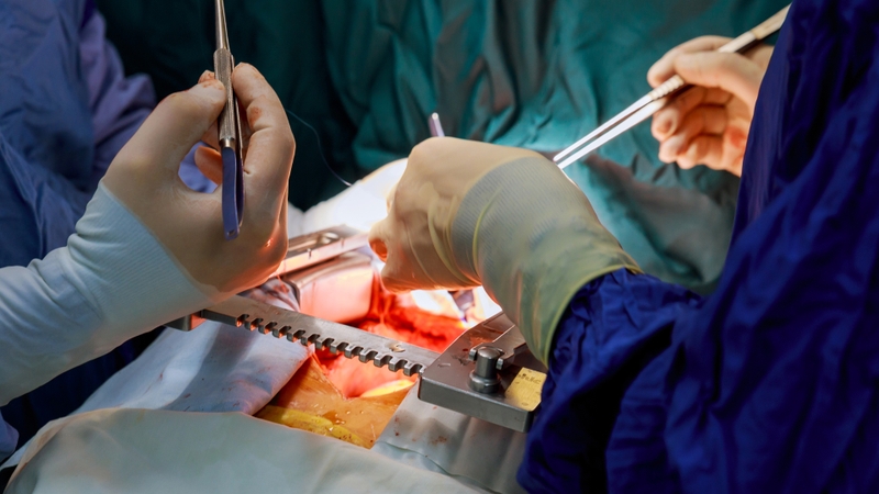 Các phương pháp phẫu thuật điều trị hẹp eo động mạch chủ 2