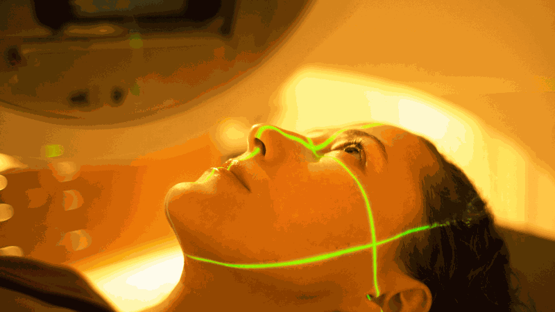 Các phương pháp xạ trị trong điều trị ung thư 2