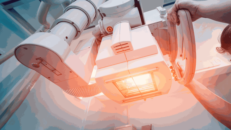 Các phương pháp xạ trị trong điều trị ung thư 3