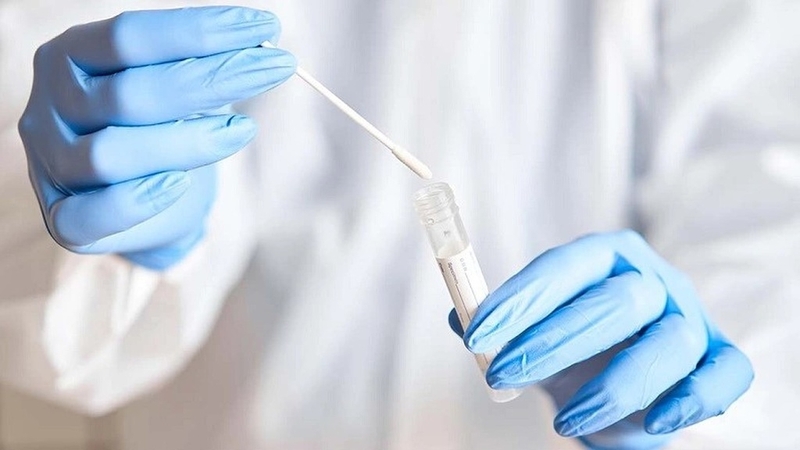 Các phương pháp xét nghiệm cúm A H1N1 chính xác nhất hiện nay 1