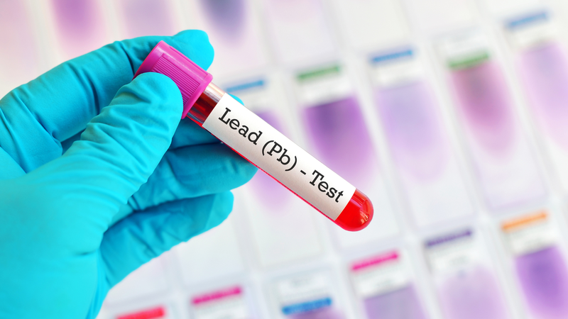 Các phương pháp xét nghiệm độc chì và biện pháp phòng ngừa 4
