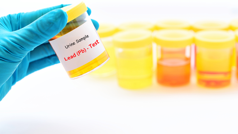 Các phương pháp xét nghiệm độc chì và biện pháp phòng ngừa 3