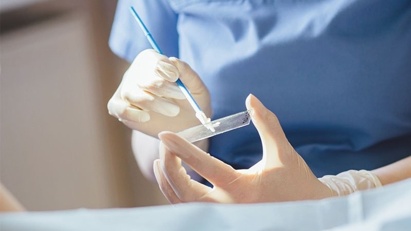 Các phương pháp xét nghiệm sàng lọc ung thư cổ tử cung 3