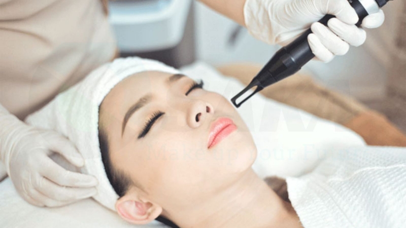 Các phương pháp xóa nốt ruồi 5