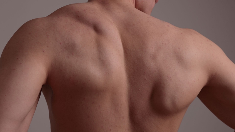 Steroid đồng hóa giúp tăng cường cơ bắp