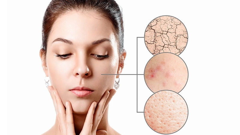 Tổng hợp các thành phần phục hồi da tốt nhất 1