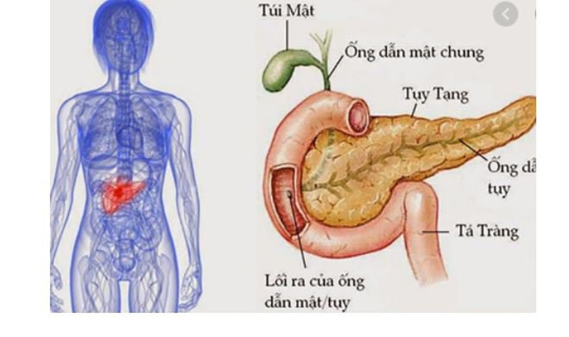 Các thực phẩm tốt cho tuyến tụy nên bổ sung mỗi ngày 1