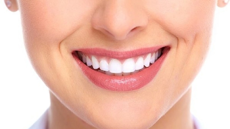 5 tiêu chí để tháo niềng răng bạn cần biết 2