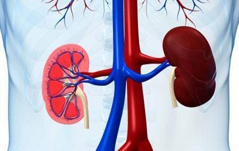 Các tiêu chuẩn chẩn đoán hội chứng thận hư là gì?3