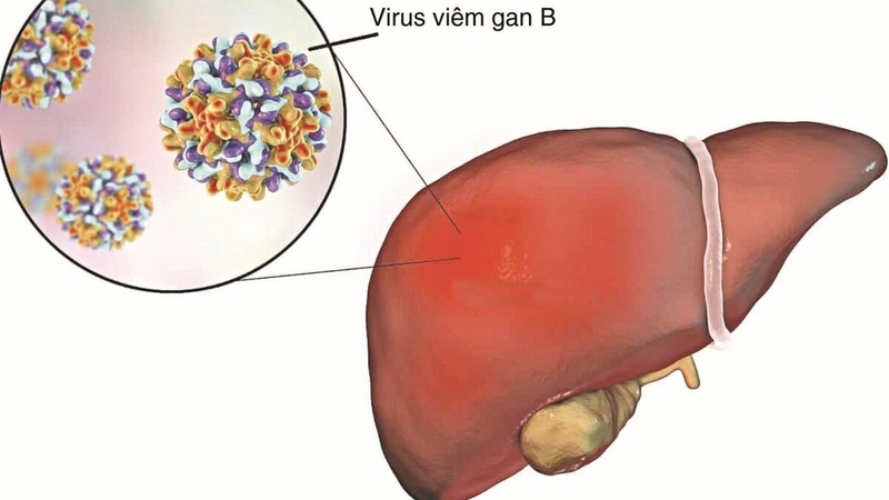 Các triệu chứng biểu hiện bệnh gan và cách phòng bệnh 0