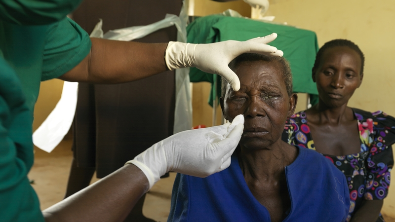 Các triệu chứng đau mắt hột mà bạn nên biết 4