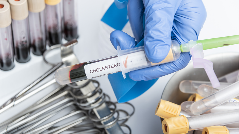 Các triệu chứng mỡ máu cao bạn nên biết - Cách phòng ngừa chứng mỡ máu cao 3