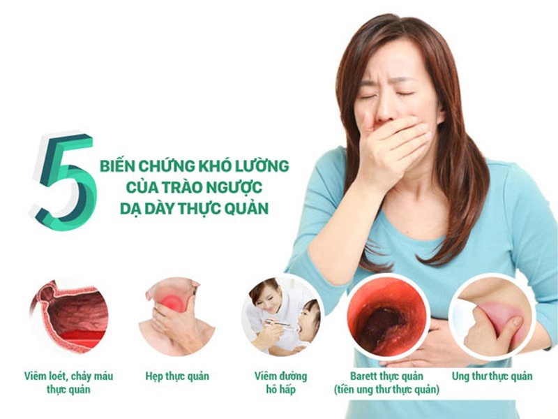 Các triệu chứng trào ngược dạ dày thực quản điển hình 2