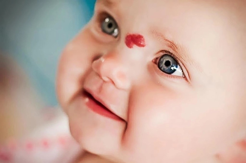 Các vết bớt ở trẻ sơ sinh thường gặp nhất và cách xử lý 6