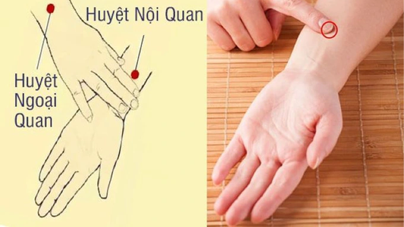 Bấm huyệt chữa rối loạn tiền đình bằng huyệt ngoại quan