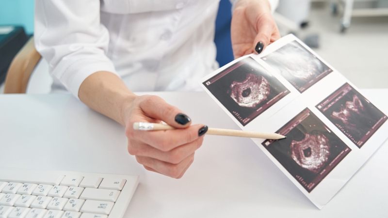 Các xét nghiệm khi mang thai 3 tháng đầu mẹ bầu cần làm là gì? 4