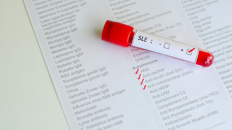 Xét nghiệm lupus ban đỏ là bước quan trọng giúp chẩn đoán và theo dõi bệnh