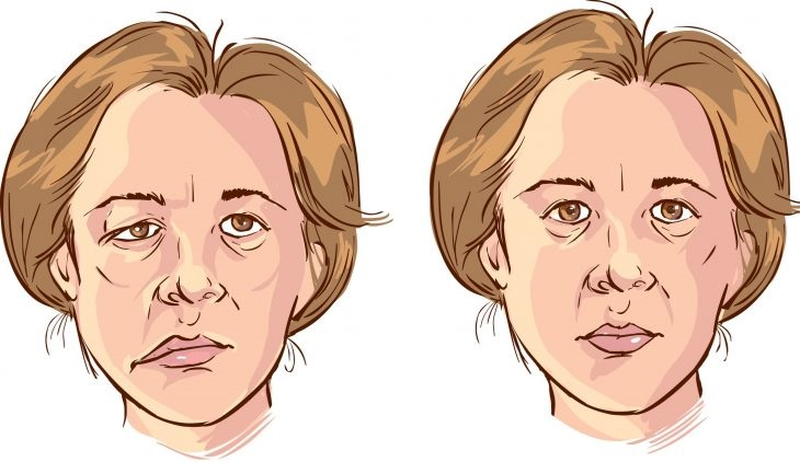 Cách bấm huyệt Địa Thương chữa nhiều bệnh lý khác nhau 2