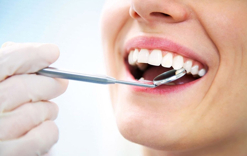 Lấy cao răng là phương pháp phá vỡ và loại bỏ các mảng bám trên răng