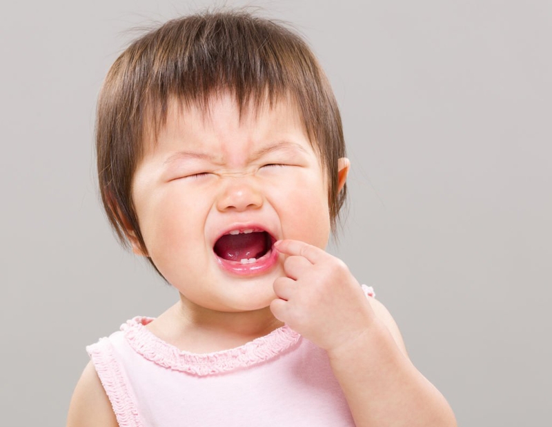 Cách bôi Vecni Fluor cho bé giúp răng thêm chắc khỏe 2