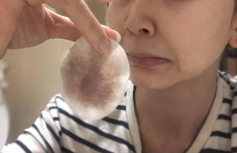 Cách cải thiện tình trạng lỗ chân lông mặt to 2