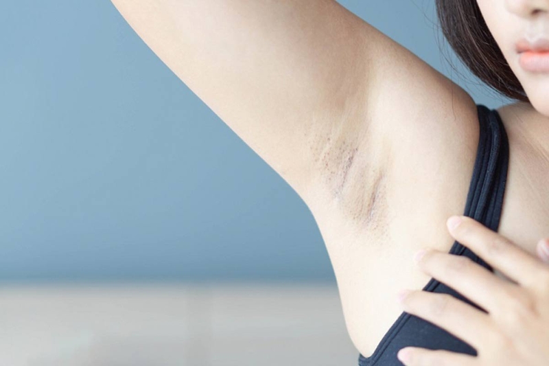 Cạo lông nách có thể gây ra những tác động xấu nhất định đến làn da của phụ nữ