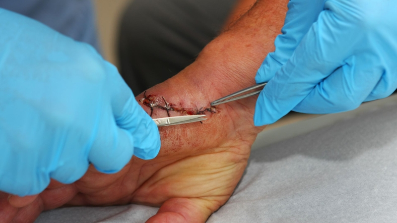 Mỗi vị trí trên cơ thể có thời điểm cắt chỉ khác nhau