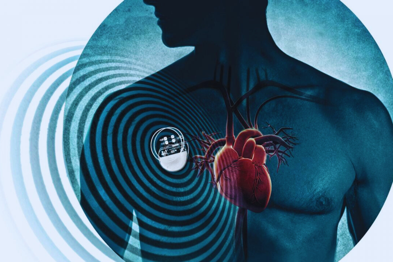 cach-cham-soc-benh-nhan-sau-dat-may-tao-nhip-tim 3.png