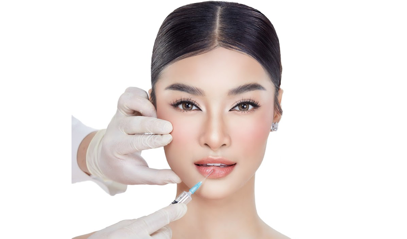 Bầm tím môi là một tác dụng ngoài ý muốn khi tiêm filler