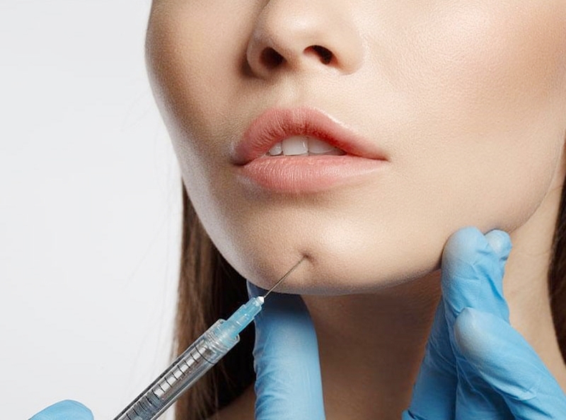 Cách chăm sóc sau khi tiêm Filler cằm để đảm bảo hiệu quả thẩm mỹ