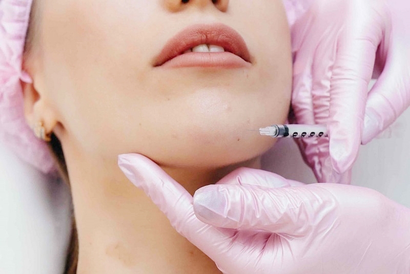 Cách chăm sóc sau khi tiêm Filler cằm để đảm bảo hiệu quả thẩm mỹ