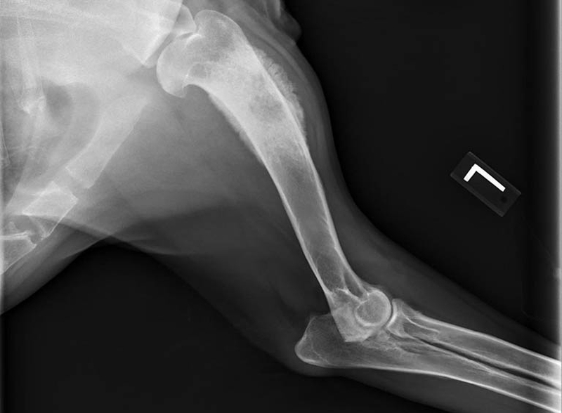 Cách chẩn đoán Sarcoma xương (U xương ác tính) ở trẻ em và thanh thiếu niên 2