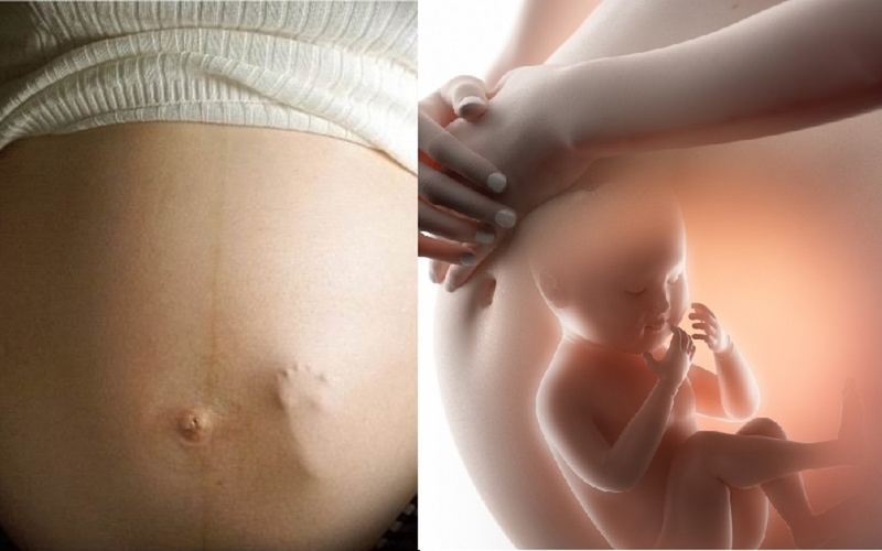 Cách chọc thai nhi đạp giúp bé phát triển trí não và phản xạ tốt 1