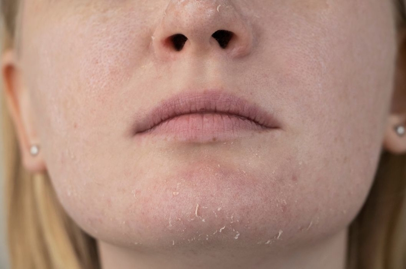 Lưu ý cách chọn kem dưỡng cho da treatment 2