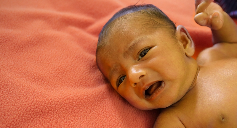 Cách chữa bệnh vàng da ở trẻ sơ sinh ba mẹ nên biết 4