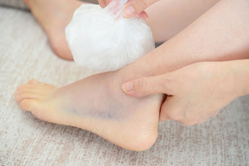 Mách bạn cách chữa bong gân cổ chân tại nhà hiệu quả 3