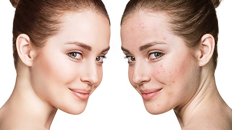 Dị ứng mỹ phẩm nên bôi thuốc gì? 3