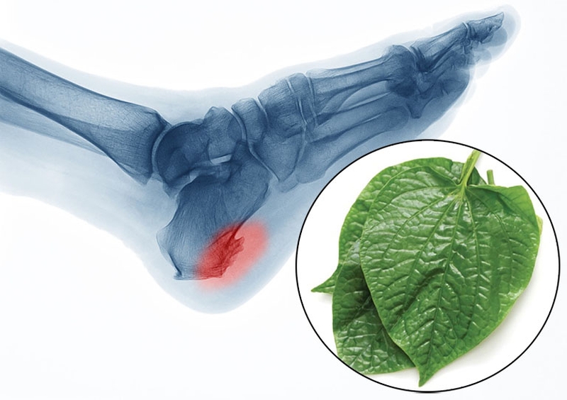 Cách chữa gai gót chân bằng lá lốt đúng cách 1