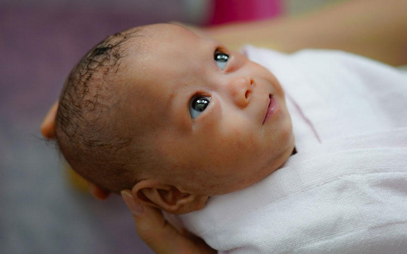 Cách chữa lác mắt cho trẻ sơ sinh 1