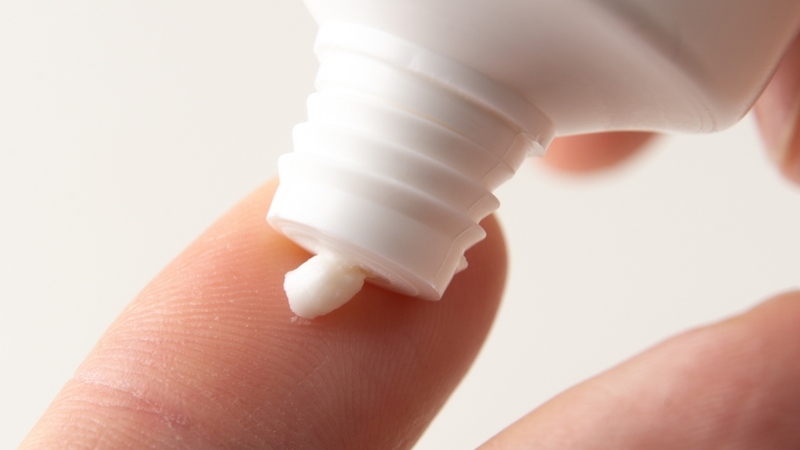 Corticoid tại chỗ là một trong những cách chữa rụng tóc từng mảng​