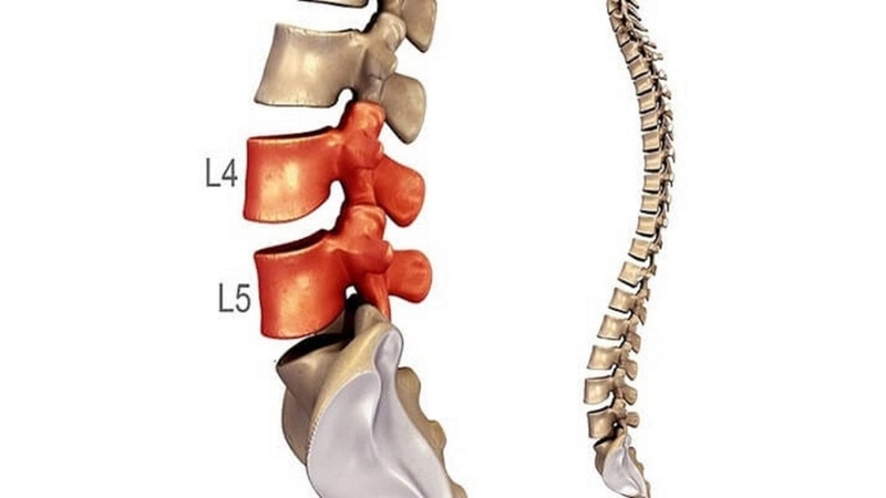 Điều trị bảo tồn kết hợp tập luyện đúng cách giúp cải thiện đau và chức năng vận động