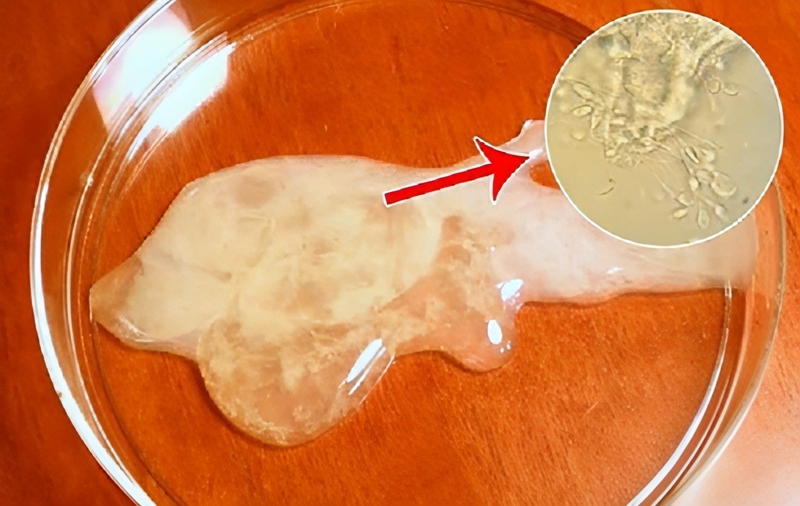 Tinh trùng yếu có độ hoá lỏng thấp