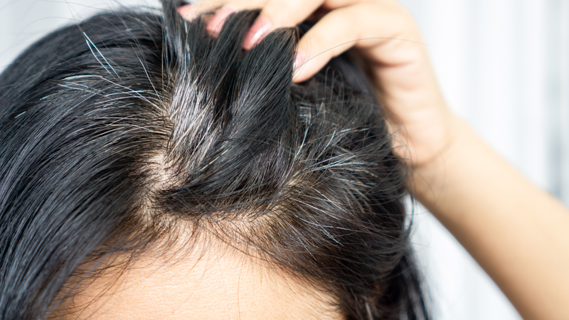 Cơ thể thiếu dưỡng chất khiến nang tóc hoạt động kém, làm giảm khả năng giữ màu tóc tự nhiên