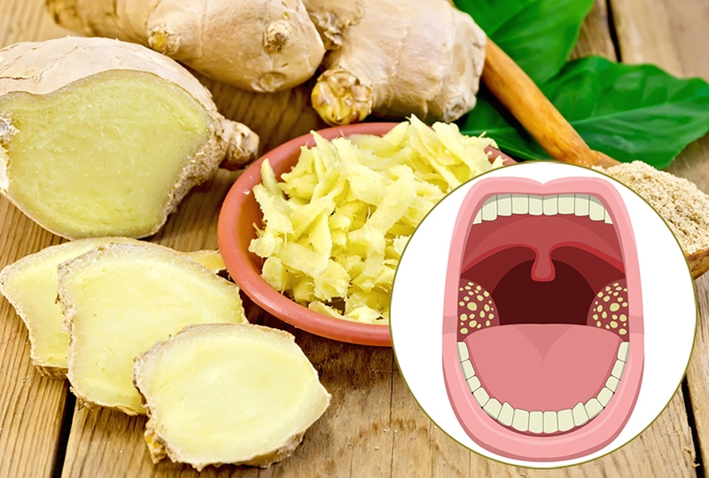 Cách chữa trị dứt điểm viêm amidan cho con hiệu quả