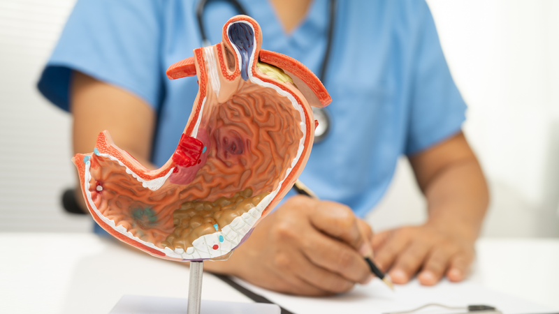 Viêm loét dạ dày có thể chữa khỏi nếu được phát hiện sớm và điều trị đúng theo hướng dẫn của bác sĩ