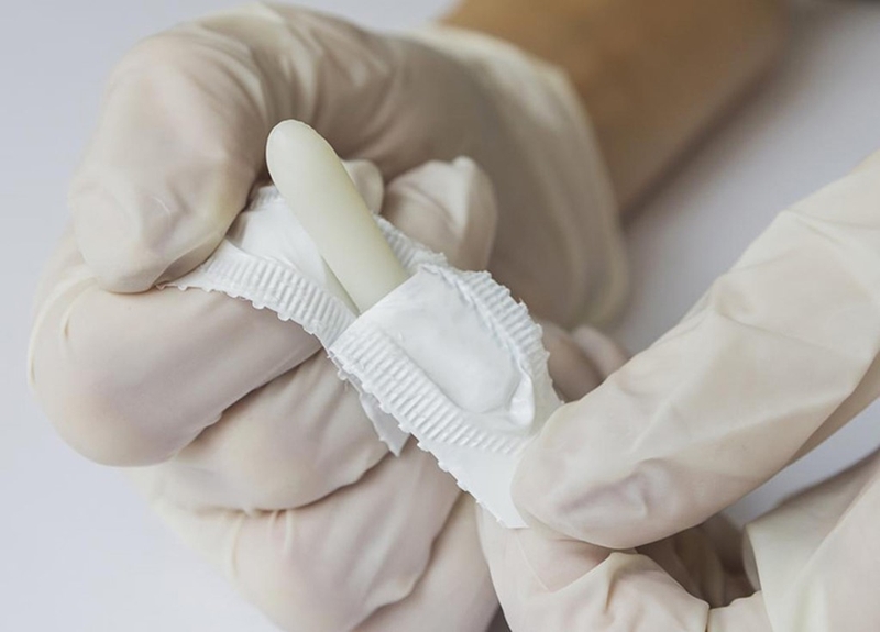 Cách đặt thuốc trĩ vào hậu môn và các lưu ý cần ghi nhớ 2