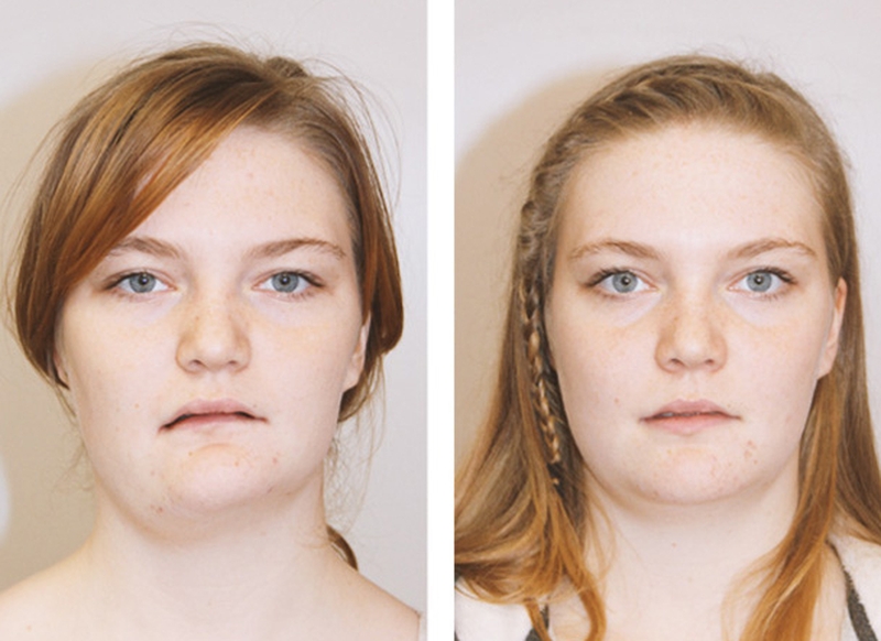 Cách để biết mặt mình có bị lệch không? 2