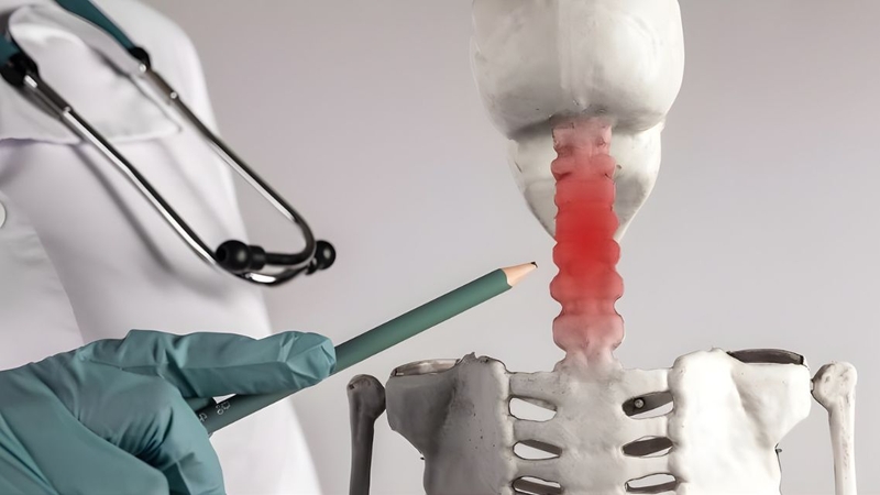 Cần có tư vấn của bác sĩ khi áp dụng&nbsp;cách điều trị thoát vị đĩa đệm cột sống cổ