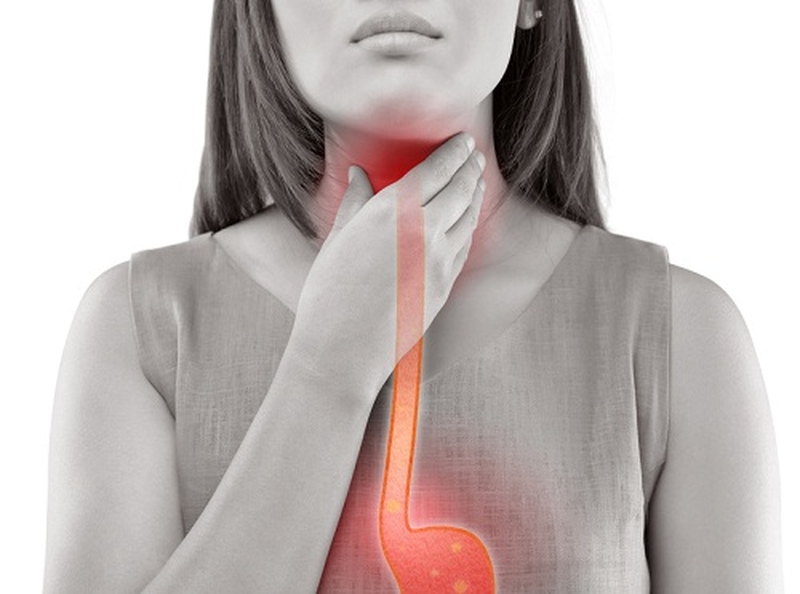 Cách điều trị trào ngược dạ dày dịch mật và biện pháp phòng bệnh mà bạn nên biết 1