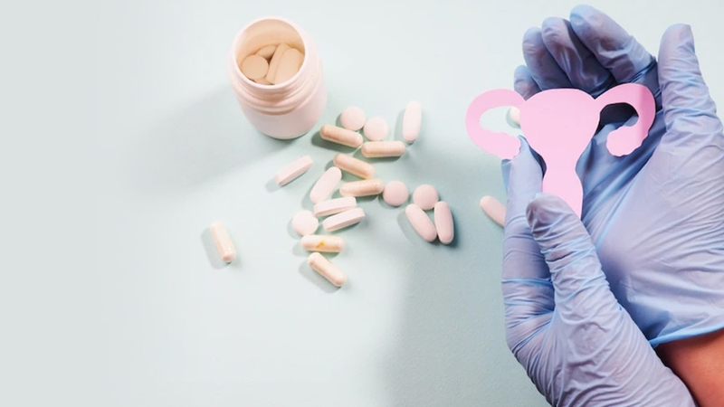 Cách điều trị u nang buồng trứng: Những phương pháp hiệu quả và lưu ý 2